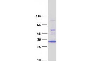 Validation with Western Blot