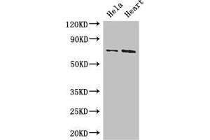 Western Blot Positive WB detected in: Hela whole cell lysate, Mouse heart tissue All lanes: PCK2 antibody at 3. (PEPCK Antikörper  (AA 101-400))