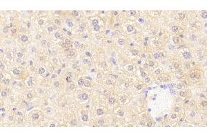 Detection of OSMR in Mouse Liver Tissue using Polyclonal Antibody to Oncostatin M Receptor (OSMR) (Oncostatin M Receptor Antikörper  (AA 410-652))