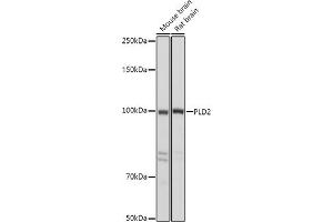 Western blot analysis of extracts of various cell lines, using PLD2 antibody (ABIN6129076, ABIN6145764, ABIN6145765 and ABIN6214347) at 1:500 dilution. (Phospholipase D2 Antikörper  (AA 1-180))