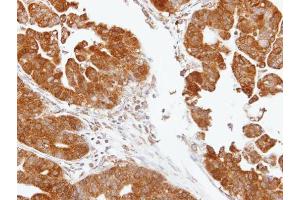 IHC-P Image Immunohistochemical analysis of paraffin-embedded human gastric, using TDP1, antibody at 1:100 dilution.