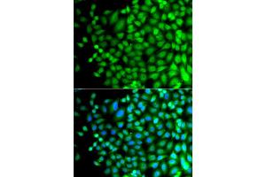Immunofluorescence analysis of A549 cells using SUPT20H antibody (ABIN5975125). (FAM48A/P38IP Antikörper)