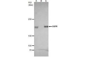 IP Image EGFR antibody [C2C3], C-term immunoprecipitates EGFR protein in IP experiments. (EGFR Antikörper  (C-Term))