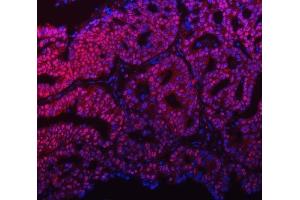 IF analysis of mSin3A/SIN3A using anti-mSin3A/SIN3A antibody (ABIN7602504). (SIN3A Antikörper  (AA 8-918))