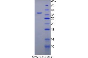 Image no. 1 for Hydroxysteroid (11-Beta) Dehydrogenase 1 (HSD11B1) (AA 1-288) protein (His tag) (ABIN4989110) (HSD11B1 Protein (AA 1-288) (His tag))