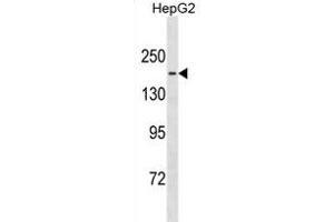 TTBK1 Antibody (Center) (ABIN1881954 and ABIN2838922) western blot analysis in HepG2 cell line lysates (35 μg/lane). (TTBK1 Antikörper  (AA 667-695))