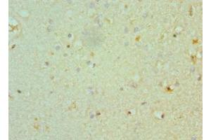 Immunohistochemistry of paraffin-embedded human brain tissue using ABIN7160351 at dilution of 1:100 (CHRM3 Antikörper  (AA 270-470))