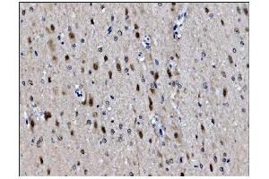 IHC analysis of JAB1 using anti-JAB1 antibody (ABIN7602482).
