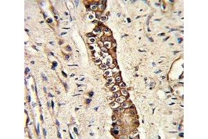 IHC analysis of FFPE human normal lung with DDR2 antibody (DDR2 Antikörper)