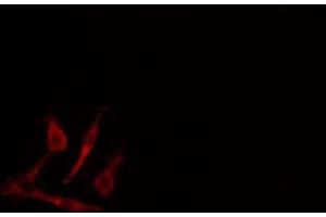 ABIN6268777 staining 293 cells by IF/ICC. (Aromatase Antikörper  (Internal Region))