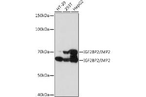 Western blot analysis of extracts of various cell lines, using IGF2BP2/IGF2BP2/IMP2 Rabbit mAb (ABIN7267903) at 1:1000 dilution. (IGF2BP2 Antikörper)