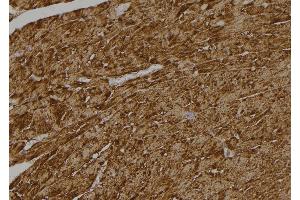 ABIN6268928 at 1/100 staining Rat heart tissue by IHC-P. (Caspase 6 Antikörper  (Cleaved-Asp179))