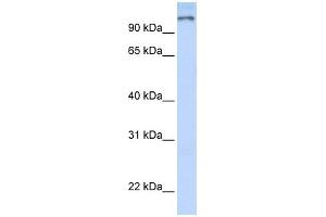 PARP9 antibody used at 1 ug/ml to detect target protein. (PARP9 Antikörper)