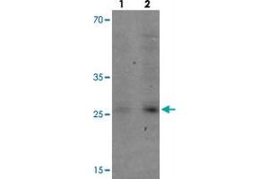 Western blot analysis of VNN3 in human brain tissue with VNN3 polyclonal antibody  at (1) 0. (VNN3 Antikörper  (C-Term))
