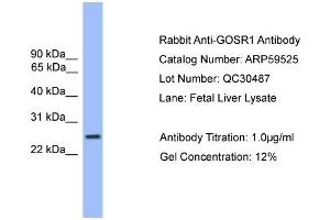 WB Suggested Anti-GOSR1  Antibody Titration: 0. (GS28 Antikörper  (C-Term))