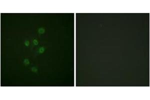 Immunofluorescence analysis of A549 cells, using HDAC3 (Phospho-Ser424) Antibody. (HDAC3 Antikörper  (pSer424))