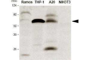 Western blot analysis The extracts of Ramos, THP-1, A20 and NIH3T3 were resolved by SDS-PAGE, transferred to PVDF membrane and probed with anti-human IRF5 antibody (1:1,000). (IRF5 Antikörper  (AA 176-240))