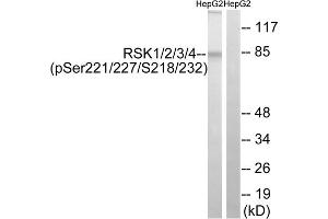 Western blot analysis of extracts from HepG2 cells, treated with EGF (200ng/ml, 30mins), using RSK1/2/3/4 (Phospho-Ser221/227/218/232) antibody. (RSK1/2/3/4 (pSer218), (pSer22), (pSer227), (pSer232) Antikörper)