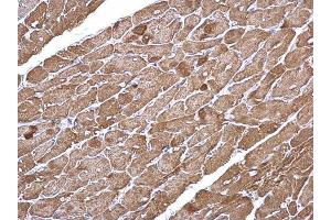 IHC-P Image alpha Cardiac Muscle Actin antibody detects alpha Cardiac Muscle Actin protein at cytoplasm on mouse heart by immunohistochemical analysis. (ACTC1 Antikörper)
