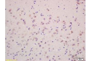 Formalin-fixed and paraffin embedded rat brain labeled with Rabbit Anti VEGF-A Polyclonal Antibody, Unconjugated (ABIN707186) at 1:200 followed by conjugation to the secondary antibody and DAB staining (VEGFA Antikörper  (AA 141-180))