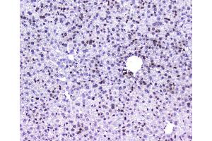 IHC analysis of AHR using anti-AHR antibody (ABIN6719265). (Aryl Hydrocarbon Receptor Antikörper)