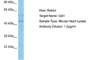 Host:  Mouse  Target Name:  GDI1  Sample Tissue:  Mouse Heart  Antibody Dilution:  1ug/ml (GDI1 Antikörper  (C-Term))