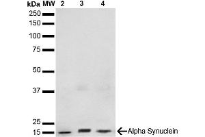Western Blot analysis of Human, Mouse, Rat Brain showing detection of 14 kDa Alpha Synuclein protein using Mouse Anti-Alpha Synuclein Monoclonal Antibody, Clone 3F8 (ABIN5564089). (SNCA Antikörper)