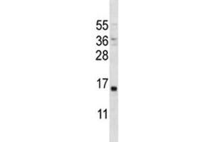 PTH antibody western blot analysis in MDA-MB231 lysate. (PTH Antikörper  (AA 59-88))