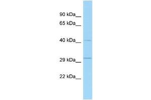 WB Suggested Anti-Tsc22d4 Antibody Titration: 1. (TSC22D4 Antikörper  (N-Term))