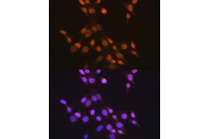 Immunofluorescence analysis of NIH-3T3 cells using CTCF antibody (ABIN7266164). (CTCF Antikörper)