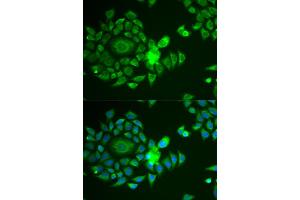 Immunofluorescence analysis of U2OS cells using NDUFS4 antibody. (NDUFS4 Antikörper)