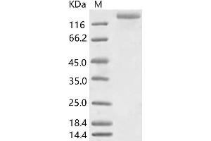 HCoV-NL63 S1 Protein protein (His tag,ECD)