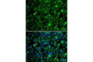 Immunofluorescence analysis of MCF-7 cells using TMLHE antibody. (TMLHE Antikörper)
