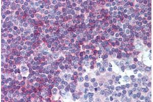 Human Tonsil (formalin-fixed, paraffin-embedded) stained with TNFRSF13C antibody ABIN239855 at 10 µg/ml followed by biotinylated anti-mouse IgG secondary antibody ABIN481714, alkaline phosphatase-streptavidin and chromogen. (TNFRSF13C Antikörper)