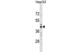 Western Blotting (WB) image for anti-RNA (Guanine-9-) Methyltransferase Domain Containing 2 (RG9MTD2) antibody (ABIN2999749) (RG9MTD2 Antikörper)