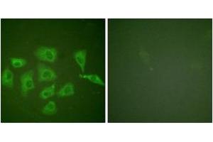 Immunofluorescence analysis of HuvEc cells, using Trk A (Ab-791) Antibody. (TRKA Antikörper  (AA 747-796))