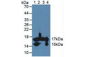 Figure. (FABP4 Antikörper  (AA 2-132))