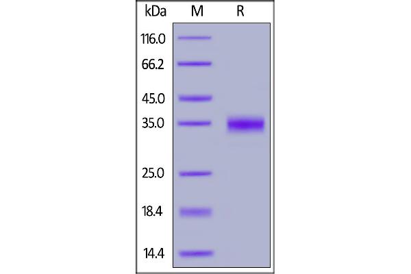 SARS-CoV-2 Spike S1 Protein (RBD) (His tag,AVI tag,Biotin)