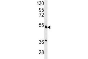 Western blot analysis of HNF4A antibody and NCI-H460 lysate. (HNF4A Antikörper  (AA 118-146))