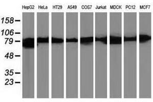 Image no. 2 for anti-Catenin (Cadherin-Associated Protein), beta 1, 88kDa (CTNNB1) antibody (ABIN1496892) (CTNNB1 Antikörper)