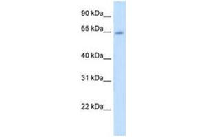Image no. 1 for anti-Steroid Sulfatase (Microsomal), Isozyme S (STS) (AA 501-550) antibody (ABIN204976) (STS Antikörper  (AA 501-550))