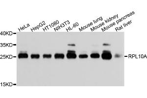 Western blot analysis of extracts of various cell lines, using RPL10A antibody (ABIN5973518) at 1/1000 dilution. (RPL10A Antikörper)