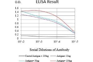 Black line: Control Antigen (100 ng),Purple line: Antigen (10 ng), Blue line: Antigen (50 ng), Red line:Antigen (100 ng) (MSH6 Antikörper  (AA 374-540))