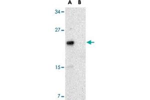 Western blot analysis of NKIRAS2 in Raw 264. (NKIRAS2 Antikörper  (C-Term))