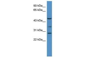 B3GALT2 Antikörper  (C-Term)