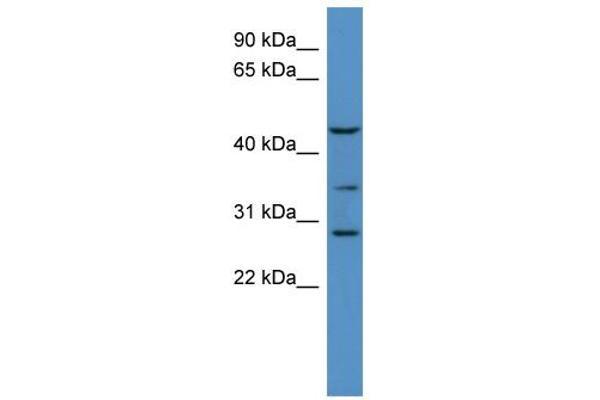 B3GALT2 anticorps  (C-Term)
