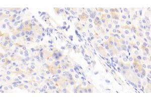 Detection of ABCD2 in Mouse Stomach Tissue using Polyclonal Antibody to ATP Binding Cassette Transporter D2 (ABCD2) (Abcd2 Antikörper  (AA 501-695))