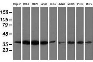 Western blot analysis of extracts (35 µg) from 9 different cell lines by using anti-ANXA3 monoclonal antibody. (Annexin A3 Antikörper)