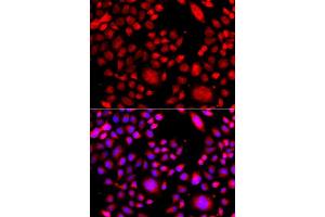 Immunofluorescence analysis of A549 cells using RAC3 antibody (ABIN5975576).