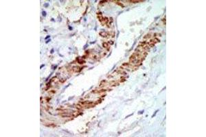 Image no. 1 for anti-Mitogen-Activated Protein Kinase Kinase Kinase 8 (MAP3K8) (C-Term) antibody (ABIN360298) (MAP3K8 Antikörper  (C-Term))
